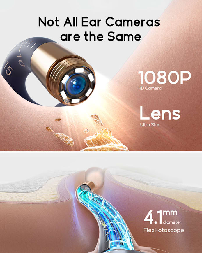 Smart Ear Cleaner Camera